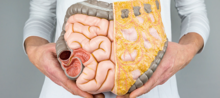 Guidance on targeted drug use for colorectal cancer
